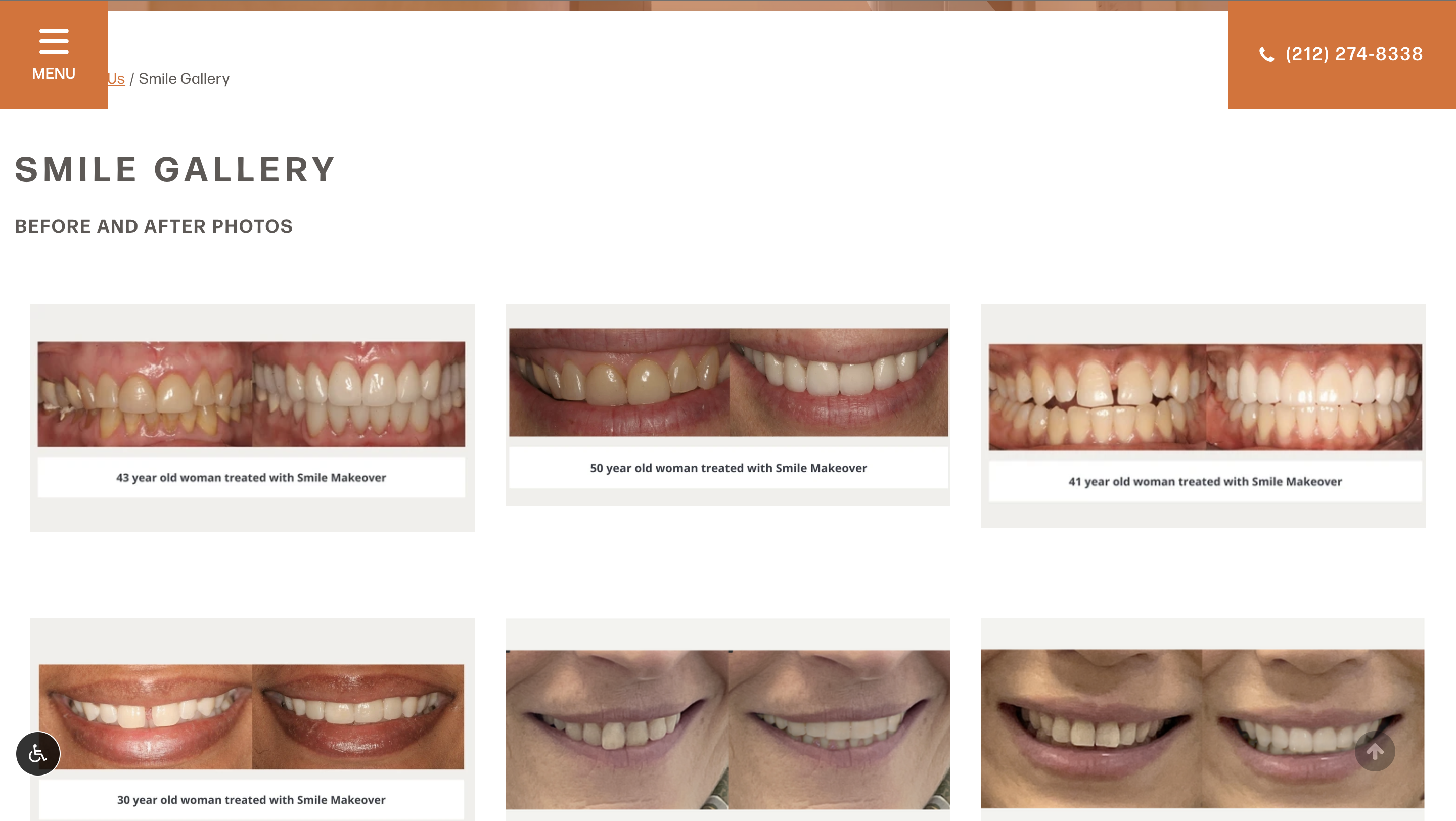 Smile gallery page showing before and after photos of dental treatments