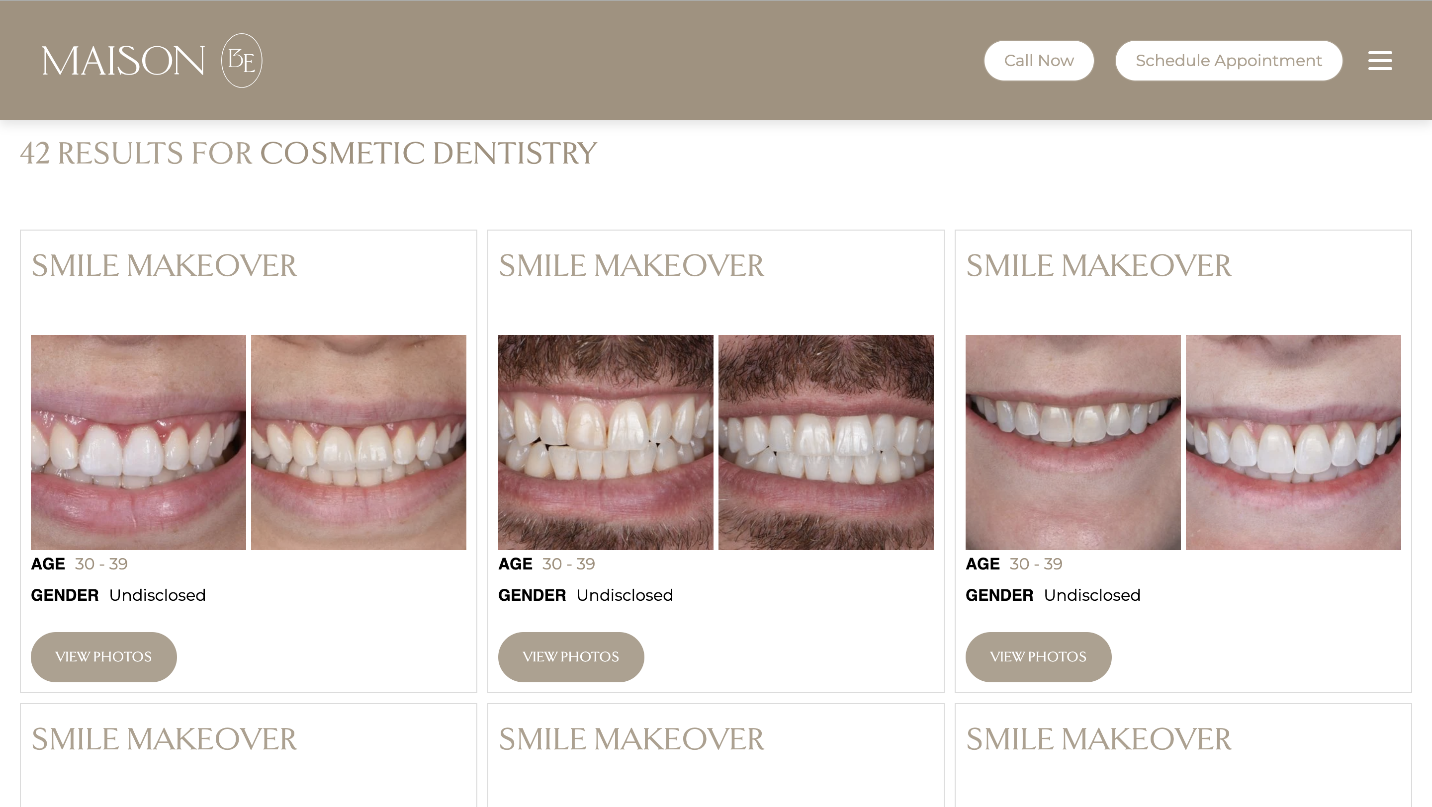 Smile makeover results gallery showing before and after transformations